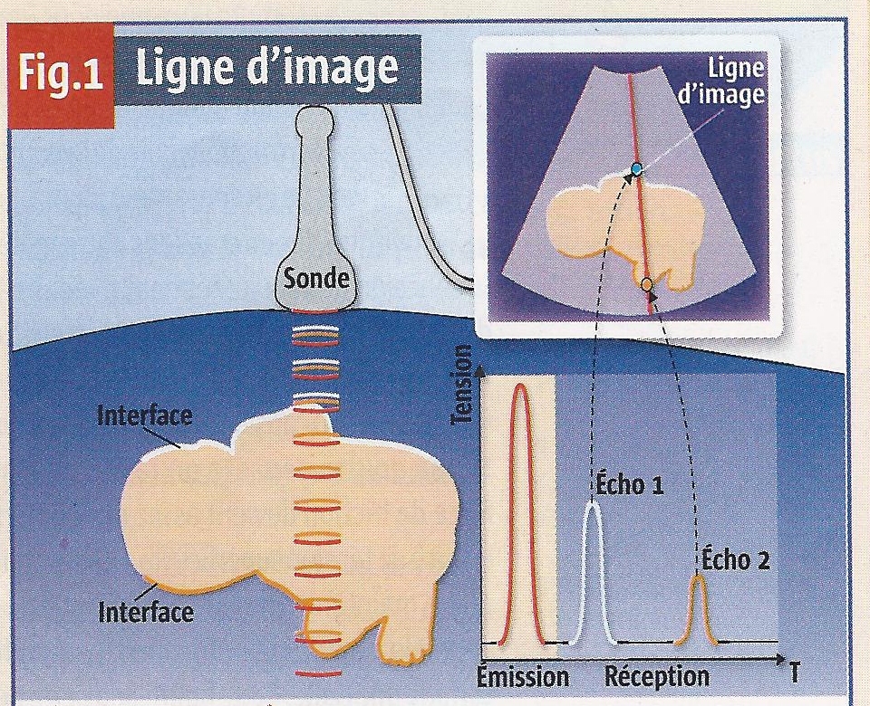 Résultats de recherche d'images pour « echographie principe »